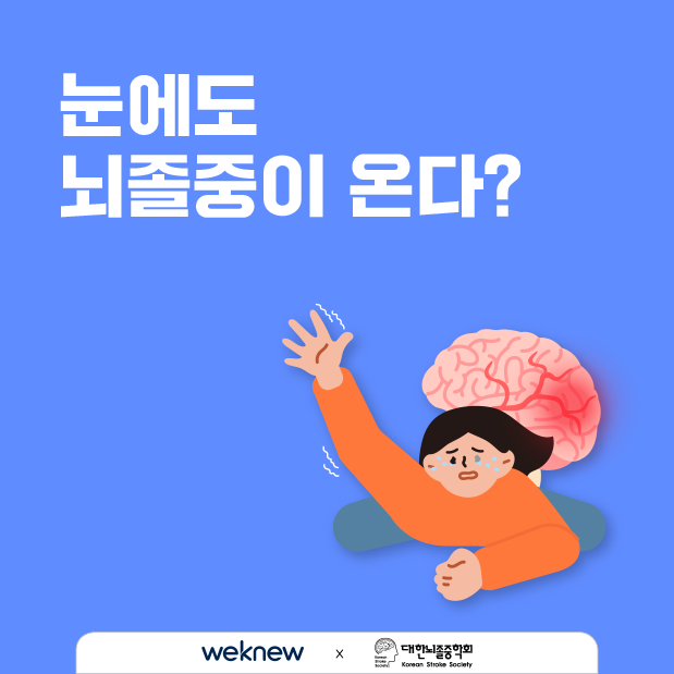 눈에도 뇌졸중이 온다 