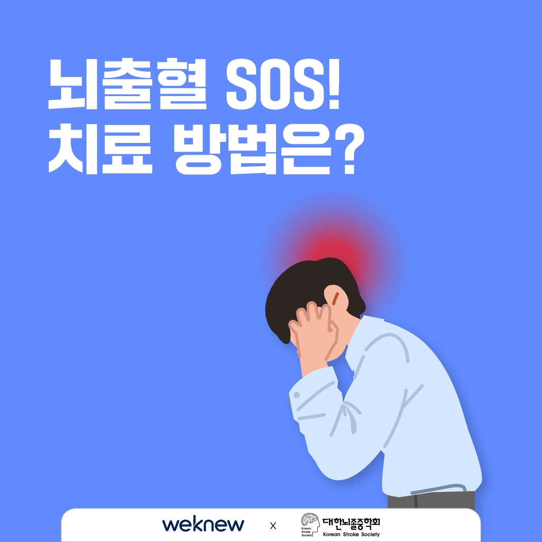 뇌출혈 SOS 치료 방법은