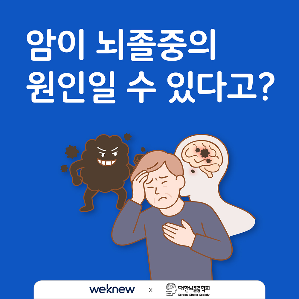 암이 뇌졸중의 원인일 수 있다고?